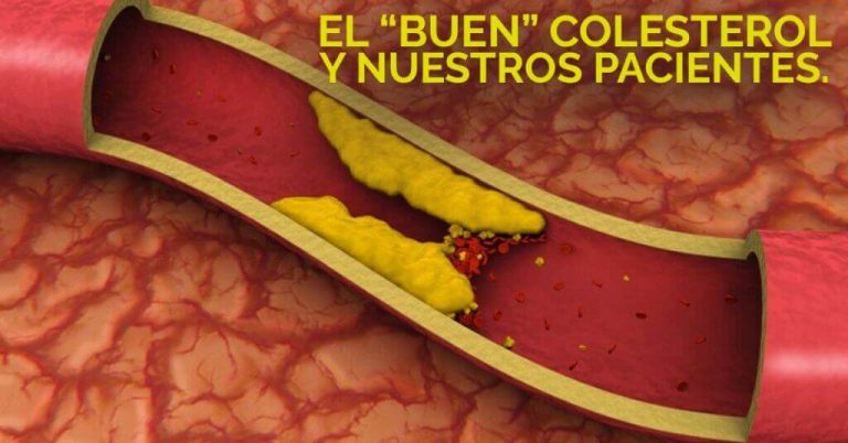 Conoce los tipos de colesterol.